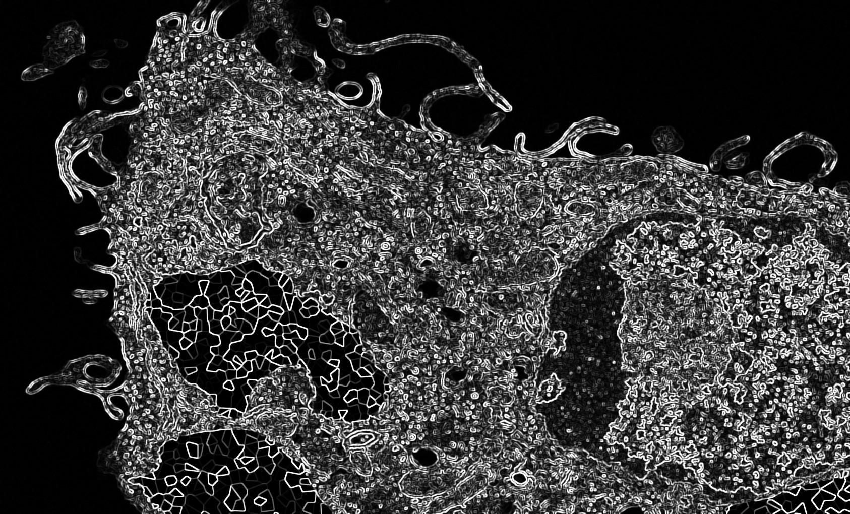 Hemozoin-containing macrophage