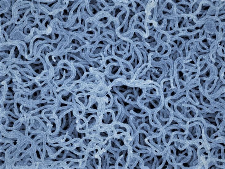 Borrelia, many cells under a scanning electron microscope